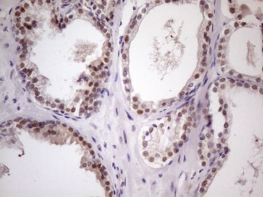 ZNF200 Antibody (clone OTI5F4)