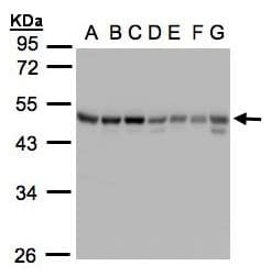 IHC-plus™ GABRB1 Antibody