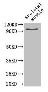 GPBB / PYGB Antibody