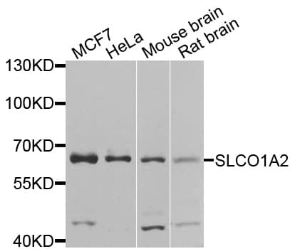 IHC-plus™ SLCO1A2 / OATP Antibody