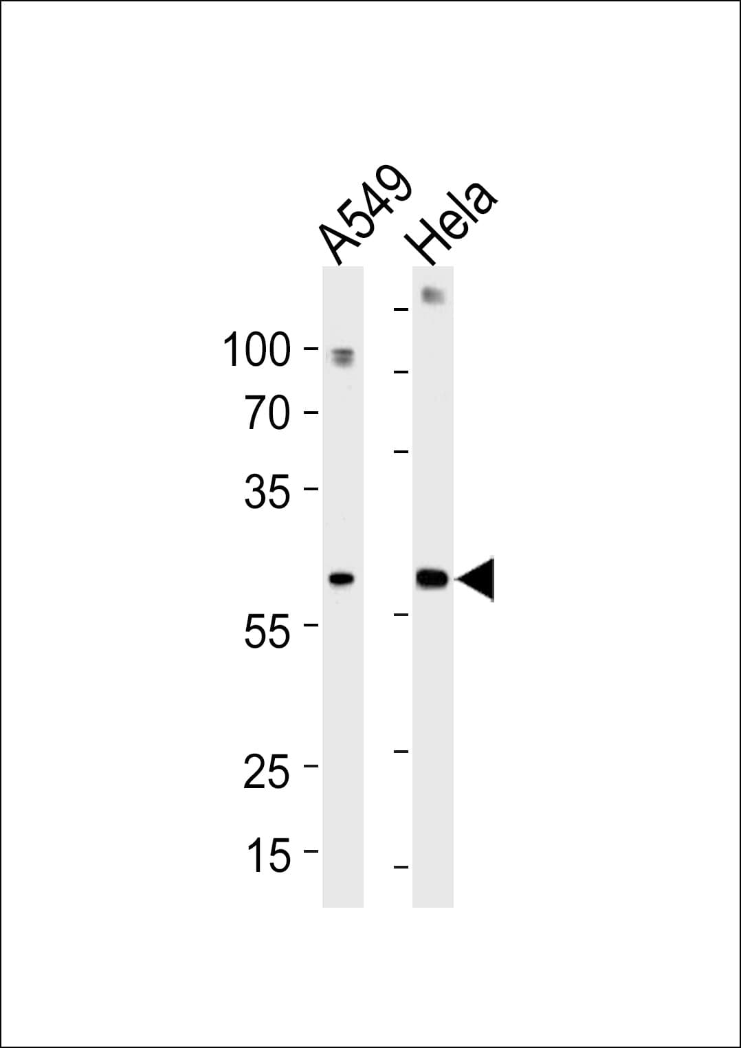 Polyclonal Rabbit anti-Human FAM50A Antibody (aa311-339, WB)