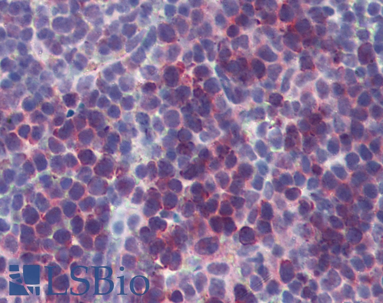 IHC-plus™ TSLP Antibody