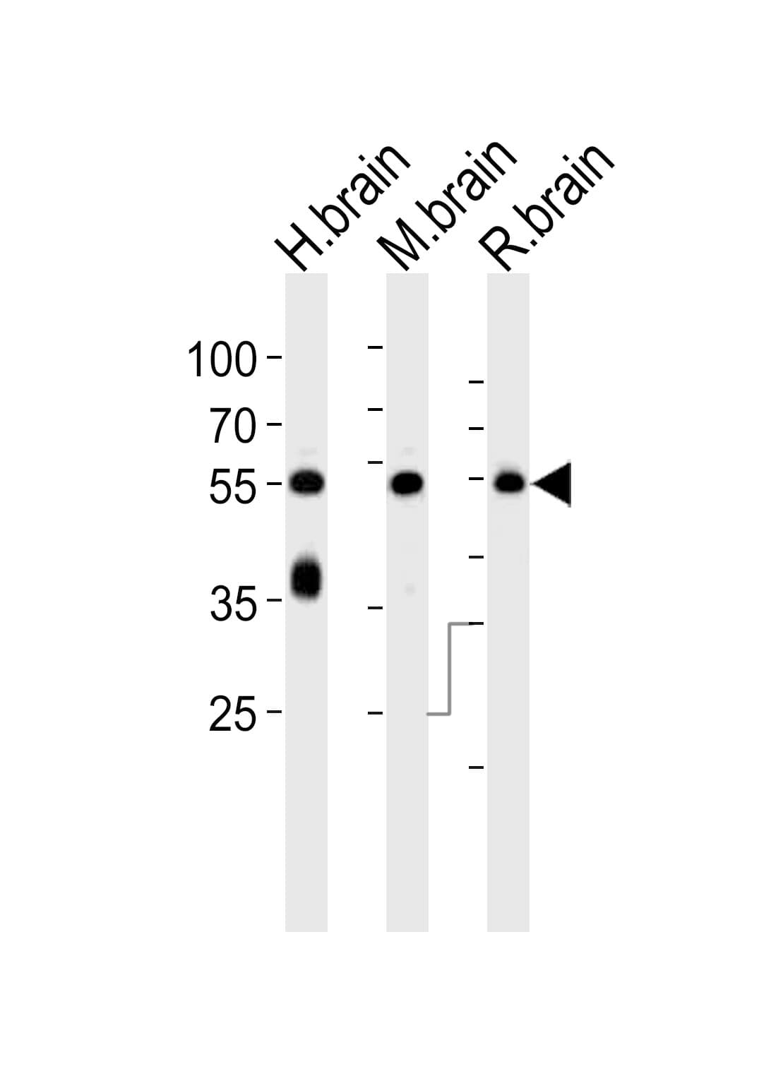 Polyclonal Rabbit anti-Human Syndapin I / PACSIN1 Antibody (aa8-38, IHC, WB)