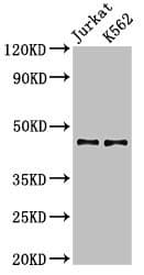 Polyclonal Rabbit anti-Human LDB1 / CLIM2 Antibody (IHC, IF, WB)