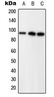 PR / Progesterone Receptor Antibody (phospho-Ser294)