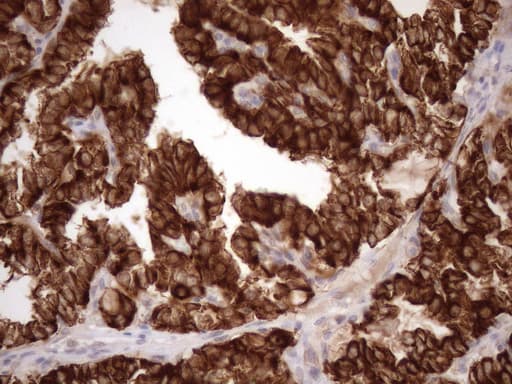 KRT16 / CK16 / Cytokeratin 16 Antibody (clone OTI2E6)