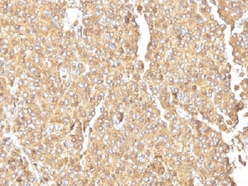 CHGA / Chromogranin A Antibody (clone LK2H10, Ready-to-Use)