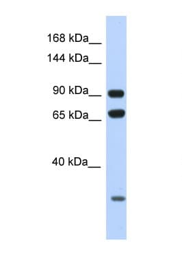 Polyclonal Rabbit anti-Human ARMC4 Antibody (aa60-109, WB)