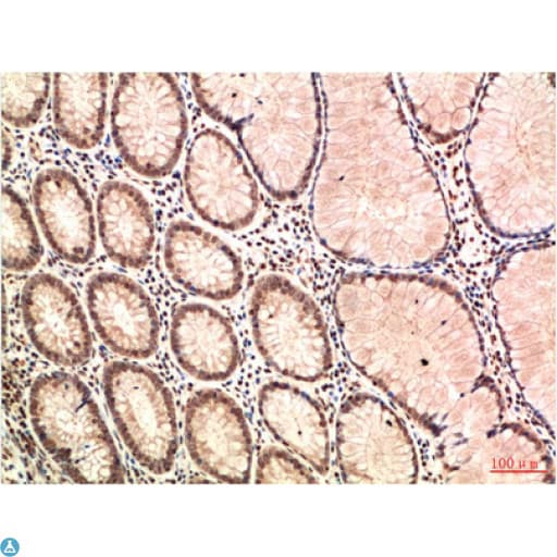 ATM Antibody