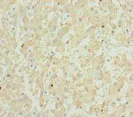 Polyclonal Rabbit anti-Human GPX5 Antibody (IHC)