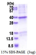 Human CRHBP Protein (Recombinant 6His, N-terminus)