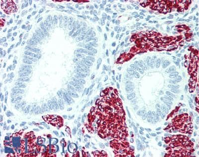 IHC-plus™ Polyclonal Rabbit anti-Human ACTA2 / Smooth Muscle Actin Antibody (IHC, WB)
