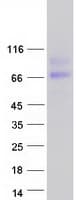 Human HEPACAM2 Protein (Recombinant Myc-DDK (Flag))