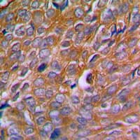 CANX / Calnexin Antibody (phospho-Ser583)