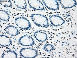 CHEK2 / CHK2 Antibody (clone OTI5C4)
