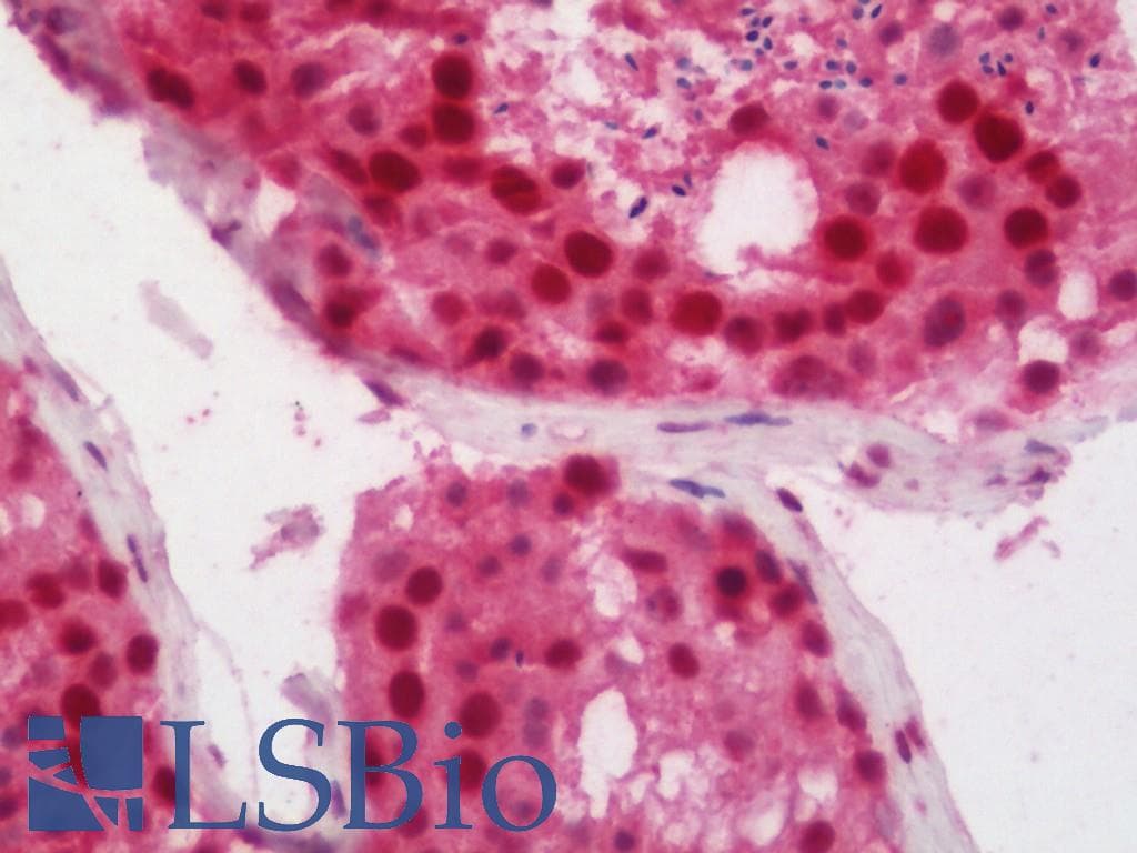 IHC-plus™ PARN Antibody