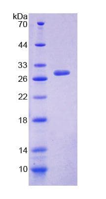 Human Dystonin / BPAG1 Protein (Recombinant His-T7)