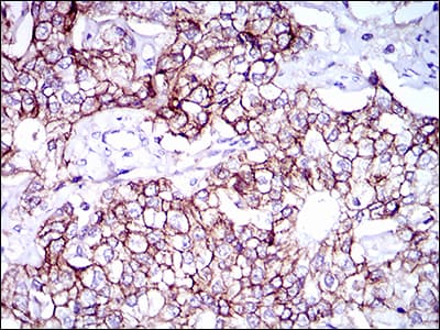 ALCAM / CD166 Antibody (aa48-216, clone 4H9A5)