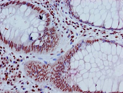 HIST1H3A Antibody