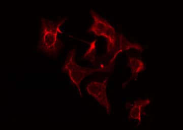 AASDHPPT / LYS5 Antibody