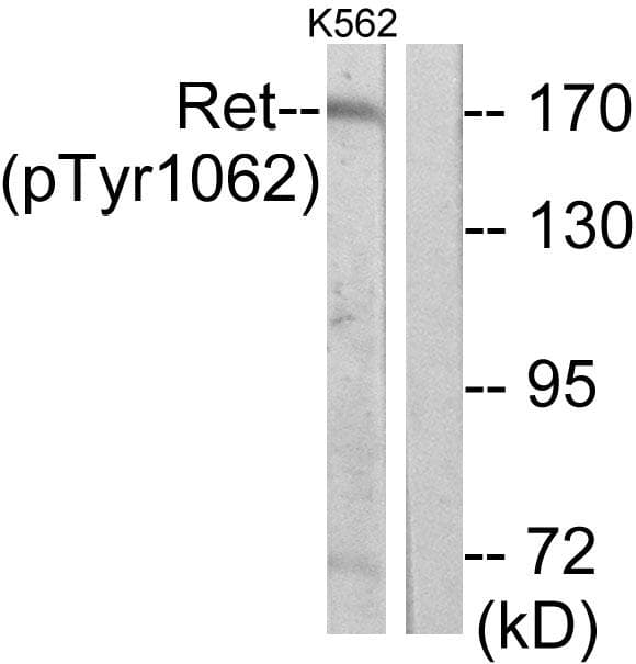 RET Antibody (phospho-Tyr1062)