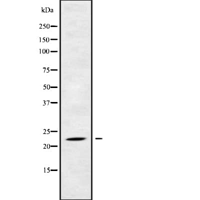 RAB17 Antibody