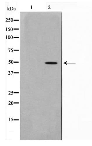 MOK / RAGE Antibody
