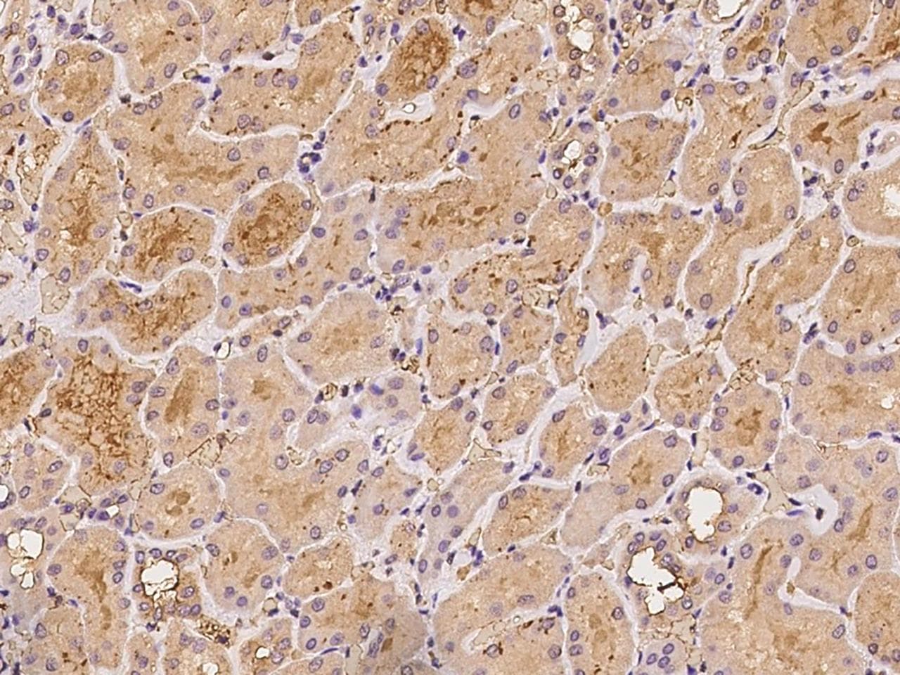 LRG1 / LRG Antibody