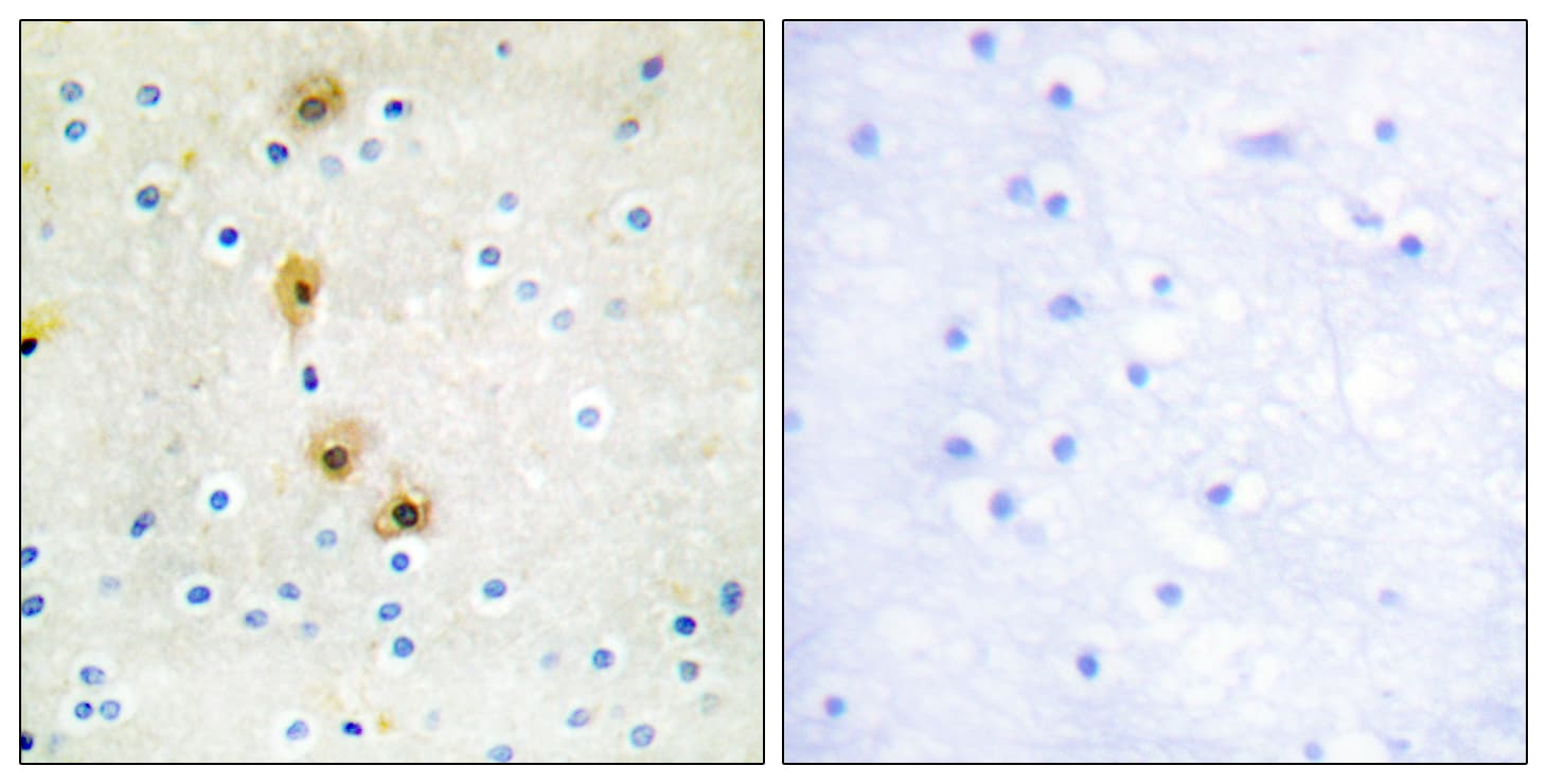 AKT1 Antibody (aa292-341)