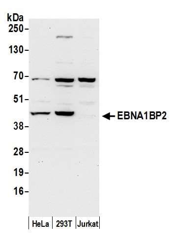 Polyclonal Rabbit anti-Human EBNA1BP2 Antibody (aa256-306, WB)