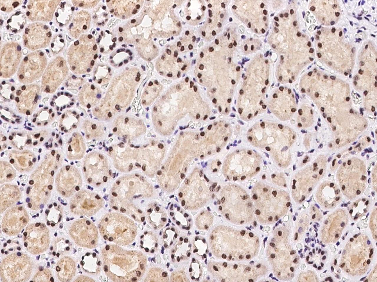 Polyclonal Rabbit anti-Human CASP5 / Caspase 5 Antibody (IHC)