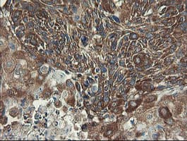 UBE2J1 Antibody (clone OTI3D1)