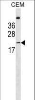 LIN7B Antibody (aa35-62)