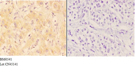 AANAT Antibody