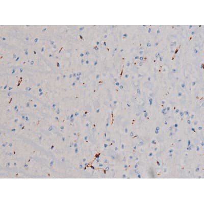 CDC25A Antibody (phospho-Ser178)