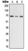 GRK5 Antibody (Internal)