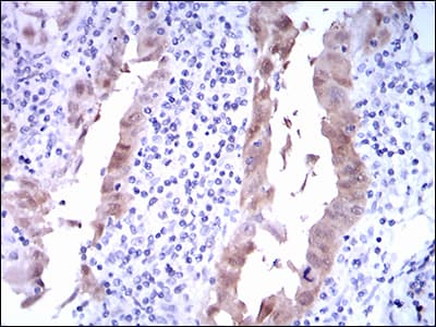 Monoclonal Mouse anti-Human p16INK4a / CDKN2A Antibody (clone 1D7D2, IHC, WB)