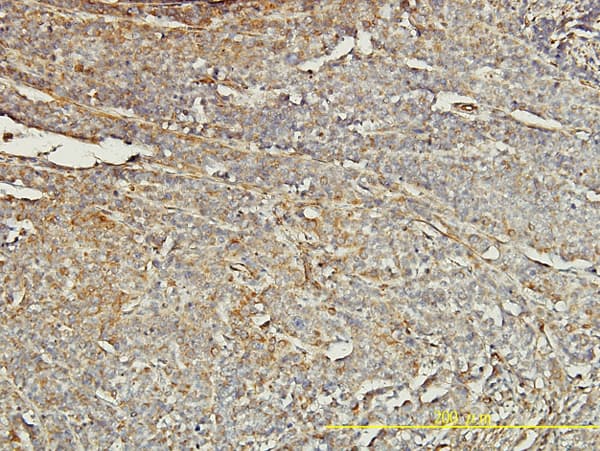 Monoclonal Mouse anti-Human TPM4 Antibody (clone 4E4-1D2, IHC, IF, WB)