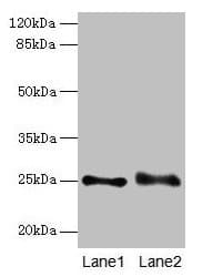 RAB3B Antibody