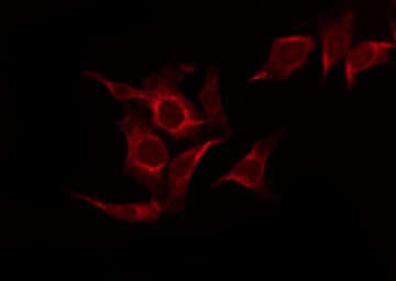 FGFR1 / FGF Receptor 1 Antibody (phospho-Tyr766)