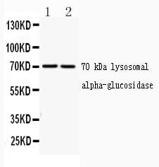 GAA / Alpha-Glucosidase, Acid Antibody