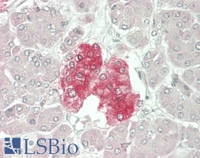 IHC-plus™ Polyclonal Rabbit anti-Human WFS1 Antibody (IHC, WB)