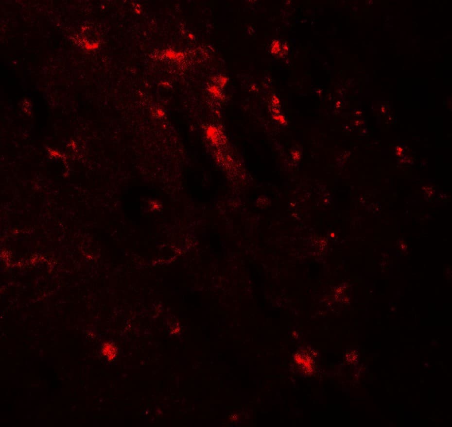 IHC-plus™ Polyclonal Rabbit anti-Human WWC1 / KIBRA Antibody (IHC, IF, WB)