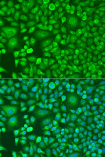 RARB / RAR Beta Antibody