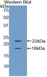 CSF2RA / CD116 Antibody (aa103-264)