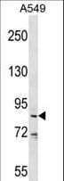 CT26 / DDX53 Antibody (aa590-619)