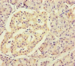 RPL34 / Ribosomal Protein L34 Antibody