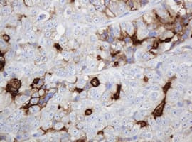 Monoclonal Mouse anti-Human ABCB1 / MDR1 / P Glycoprotein Antibody (clone OTI2C7, IHC, WB)