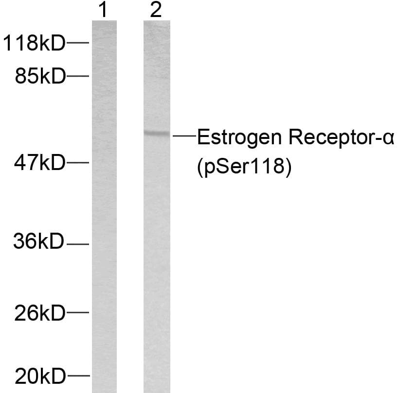 Polyclonal Rabbit anti-Human ER Alpha / Estrogen Receptor Antibody (phospho-Ser118, IHC, WB)