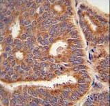 HACD2 / PTPLB Antibody (aa226-254)